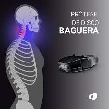 Prótese de disco cervical m6